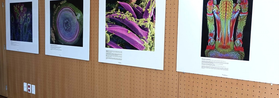 Biblioteca Municipal mostra “Vida Ampliada”